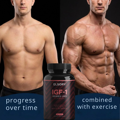 IGF Series - LR3 Complex