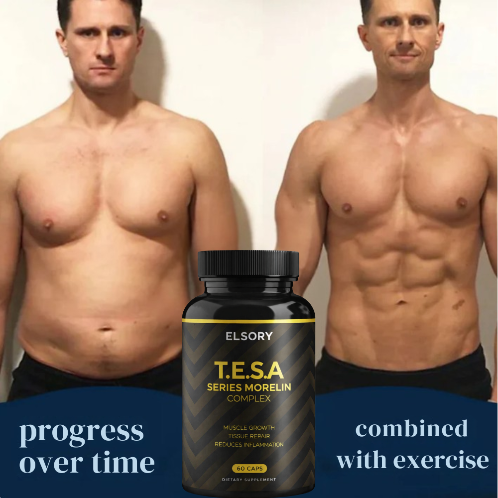 TESA Series - Morelin Complex