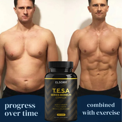 TESA Series - Morelin Complex